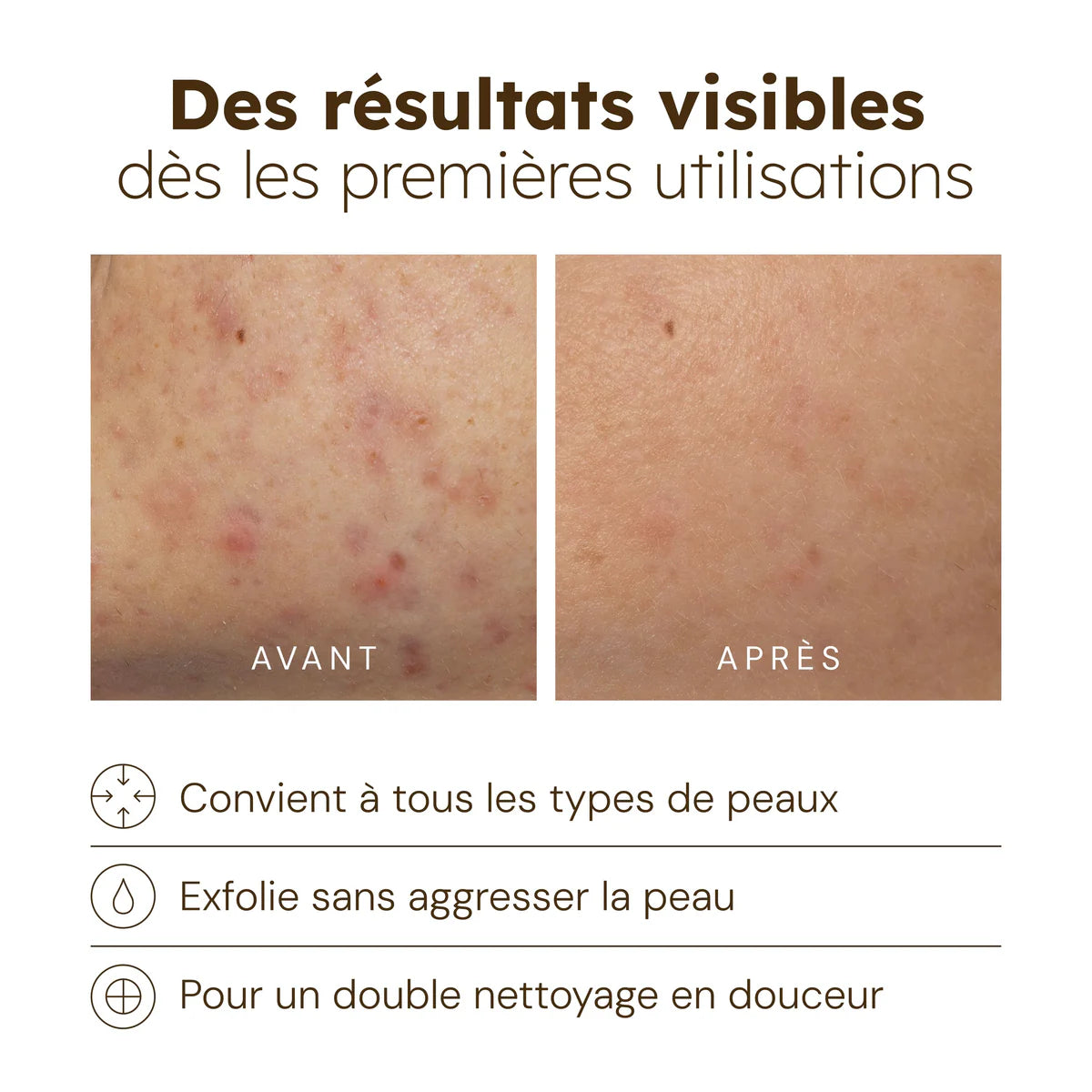 Mousse Purifiante Anti-Taches Au Curcuma