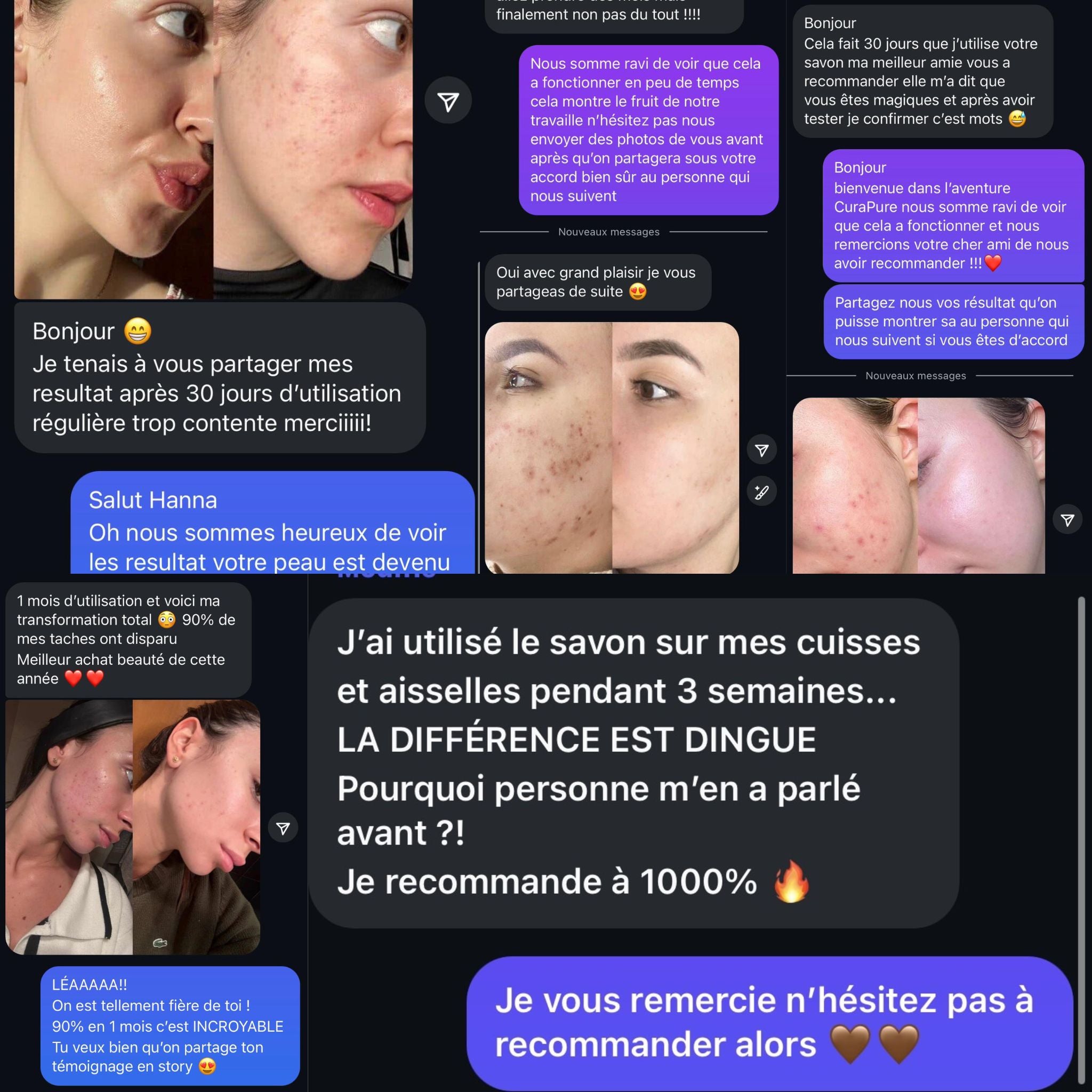 Savon Anti-Taches & Hyperpigmentation au Curcuma