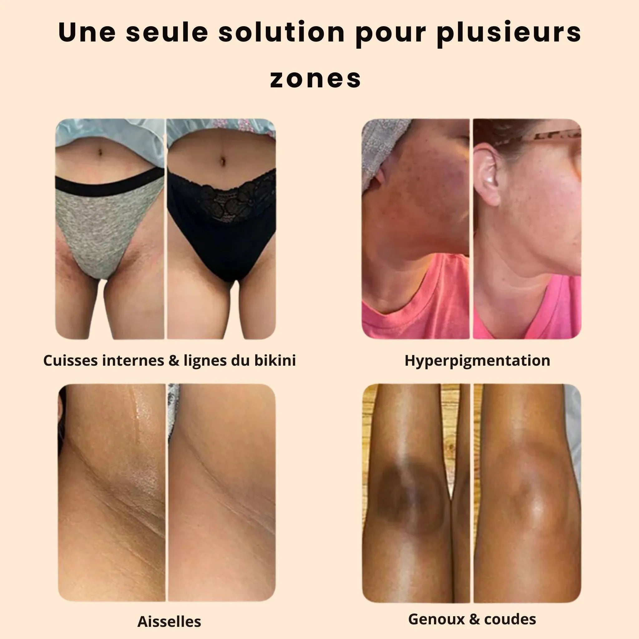 Savon Anti-Taches & Hyperpigmentation au Curcuma