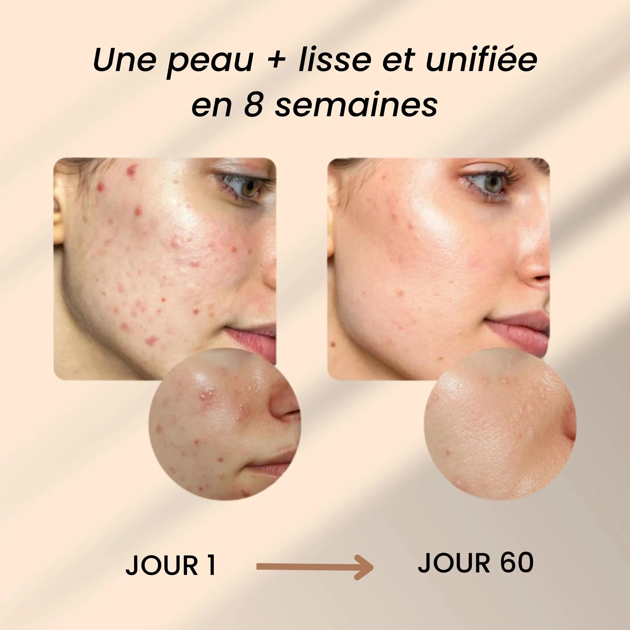 Savon Anti-Taches & Hyperpigmentation au Curcuma