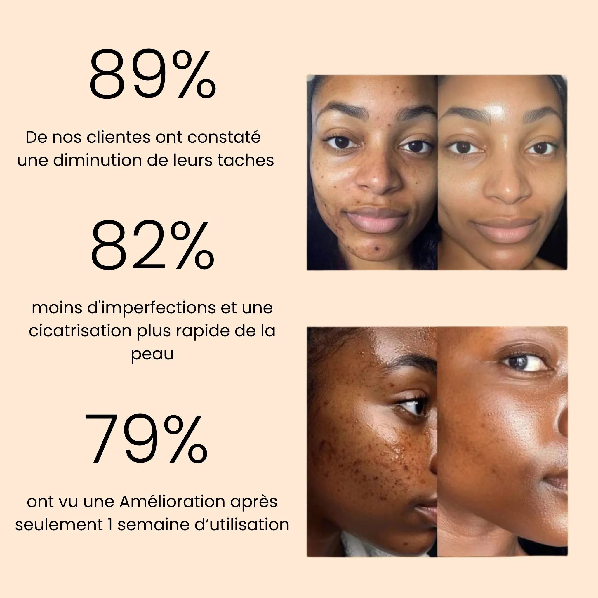 Savon Anti-Taches & Hyperpigmentation au Curcuma